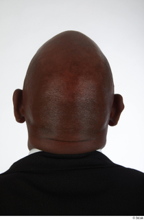 Photos Gael Casaus bald head 0005.jpg